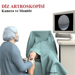  Artroskopi